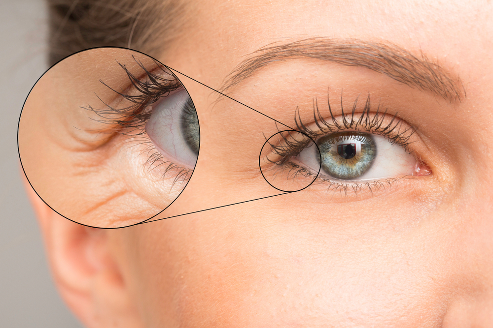 Círculo focado em rugas no olho da mulher.