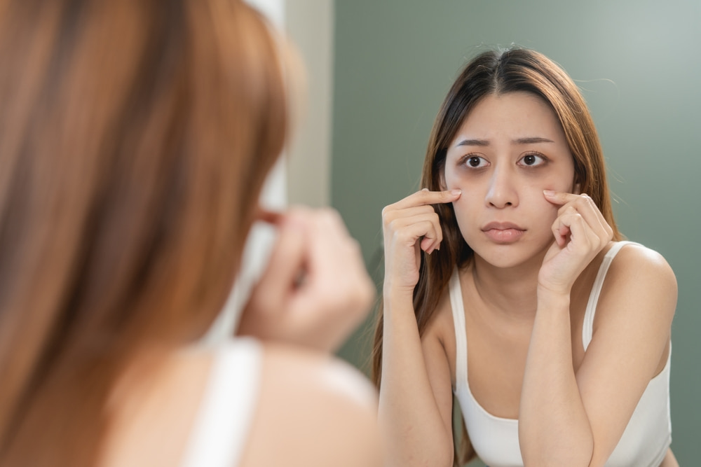 Mulher olhando suas olheiras pelo espelho.